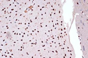 Immunohistochemistry of paraffin-embedded rat brain using FUBP1 Rabbit mAb (ABIN7267128) at dilution of 1:100 (40x lens). (FUBP1 anticorps)