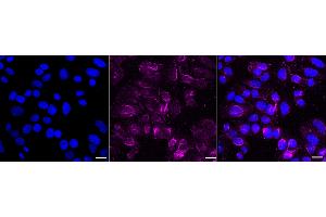 anti-Proteasome (Prosome, Macropain) 26S Subunit, ATPase, 4 (PSMC4) antibody