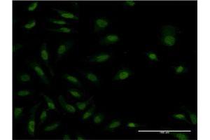 Immunofluorescence of monoclonal antibody to ZAK on HeLa cell.