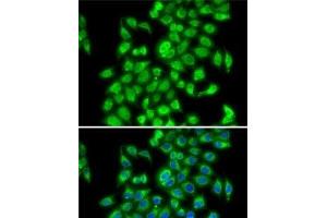 Immunofluorescence analysis of MCF7 cells using COPS3 Polyclonal Antibody (COPS3 anticorps)
