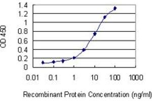 anti-N-Acetyltransferase 8B (GCN5-Related, Putative, Gene/pseudogene) (NAT8B) (AA 83-179) antibody