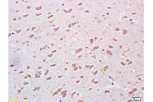 Formalin-fixed and paraffin embedded rat brain tissue labeled Anti-PEGF Polyclonal Antibody, Unconjugated  at 1:200, followed by conjugation to the secondary antibody and DAB staining