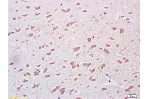 Formalin-fixed and paraffin embedded rat brain tissue labeled Anti-PEGF Polyclonal Antibody, Unconjugated  at 1:200, followed by conjugation to the secondary antibody and DAB staining (PEDF anticorps  (AA 201-300))