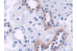 DAB staining on IHC-P; Samples: Rat Kidney Tissue (PIM1 anticorps  (AA 38-177))