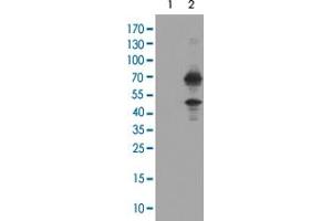 Western Blot analysis of HEK293T cells (Lane 1: transfected with pCMV6-ENTRY control and Lane 2: transfected with pCMV6-ENTRY TRMT2A cDNA) with TRMT2A monoclonal antibody, clone 1G8 . (TRMT2A anticorps)