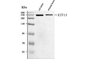 Western blot analysis of KIF1A using anti-KIF1A antibody (ABIN7599679).