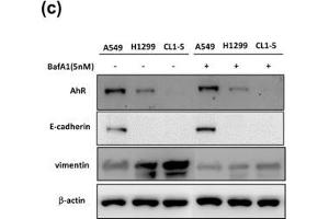 Level of autophagy-related protein expression in different cells was correlated with their cell motility. (Vimentin anticorps)