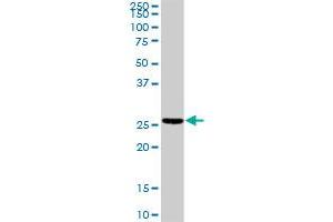 TNNI2 MaxPab rabbit polyclonal antibody. (TNNI2 anticorps  (AA 1-182))