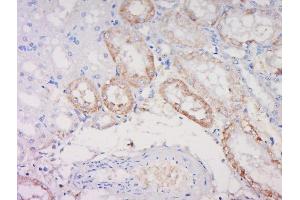 Paraformaldehyde-fixed, paraffin embedded rat kidney, Antigen retrieval by boiling in sodium citrate buffer (pH6) for 15min, Block endogenous peroxidase by 3% hydrogen peroxide for 30 minutes, Blocking buffer (normal goat serum) at 37°C for 20min, Antibody incubation with Noggin Polyclonal Antibody, Unconjugated  at 1:500 overnight at 4°C, followed by a conjugated secondary and DAB staining.