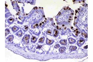 IHC analysis of TFF3 using anti-TFF3 antibody .