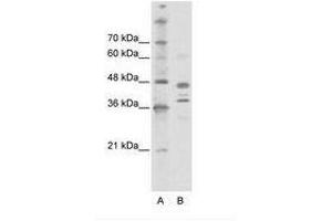 Image no. 1 for anti-SWI/SNF Related, Matrix Associated, Actin Dependent Regulator of Chromatin, Subfamily B, Member 1 (SMARCB1) (AA 212-261) antibody (ABIN6736126) (SMARCB1 anticorps  (AA 212-261))