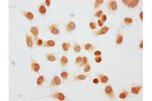 Immunocytochemistry analysis of ABIN7139280 diluted at 1:10 and staining in Hela cells performed on a Leica BondTM system.