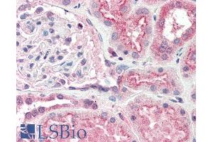 ABIN190757 (5µg/ml) staining of paraffin embedded Human Kidney. (OGG1 anticorps  (Internal Region))