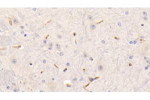 Detection of FGg in Mouse Spinal cord Tissue using Polyclonal Antibody to Fibrinogen Gamma (FGg)
