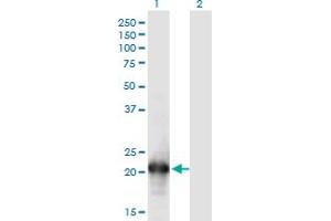 Western Blot analysis of HN1L expression in transfected 293T cell line by HN1L monoclonal antibody (M05), clone 1G8. (HN1L anticorps  (AA 1-190))