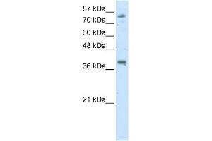 WB Suggested Anti-TSC22D2 Antibody Titration:  2. (TSC22D2 anticorps  (C-Term))