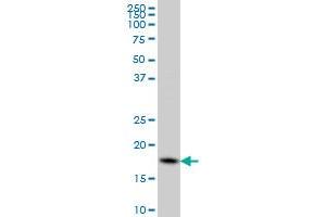 CFL1 monoclonal antibody (M04), clone 1A1 Western Blot analysis of CFL1 expression in HeLa .