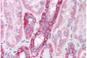Human Kidney (formalin-fixed, paraffin-embedded) stained with POLR2B antibody ABIN214136 at 5 ug/ml followed by biotinylated goat anti-rabbit IgG secondary antibody ABIN481713, alkaline phosphatase-streptavidin and chromogen.