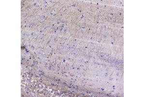 IHC analysis of Betacellulin using anti-Betacellulin antibody .