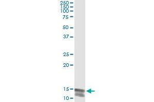 anti-Neuroligin Y (NLGN4Y) (AA 1-134) antibody