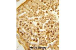 Formalin-fixed and paraffin-embedded human testis tissue reacted with BAHD1 Antibody (C-term), which was peroxidase-conjugated to the secondary antibody, followed by DAB staining.