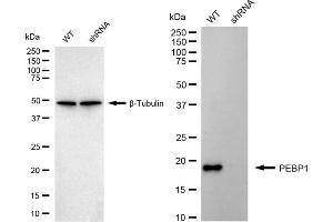 Western blotting analysis using PEBP1 antibody (ABIN7799790). (Recombinant PEBP1 anticorps)
