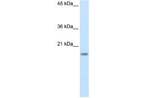 WB Suggested Anti-RPS14 Antibody Titration:  2. (RPS14 anticorps  (Middle Region))