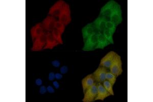 ASAP1 Mouse Monoclonal Antibody staining Hela cells by IF/ICC.