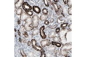 Immunohistochemical staining of human kidney shows strong cytoplasmic and membranous positivity in cells in tubules.
