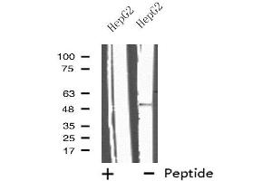 Western blot analysis of extracts from HepG2 cells, using IL13RA2 antibody. (IL13RA2 anticorps  (C-Term))