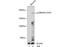 Western blot analysis of extracts of various cell lines, using Phospho-GRIN2B-Y1474 pAb (ABIN6135230, ABIN6136094, ABIN6136095 and ABIN6225667) at 1:1000 dilution. (GRIN2B anticorps  (pTyr1474))