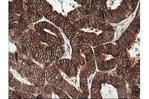 Image no. 9 for anti-TAP Binding Protein-Like (TAPBPL) antibody (ABIN1501300)