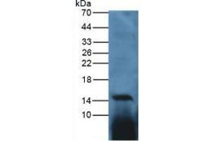 Western blot analysis of Chicken Spleen Tissue. (IL-17 anticorps  (AA 25-169))