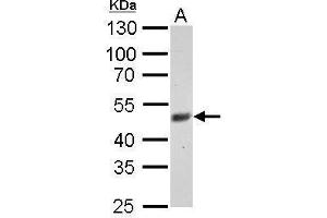 WB Image FBXL3 antibody detects FBXL3 protein by Western blot analysis.