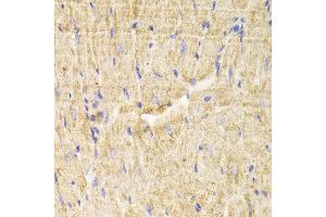 Immunohistochemistry of paraffin-embedded Mouse heart using PDLIM5 antibody at dilution of 1:100 (x400 lens). (PDLIM5 anticorps)