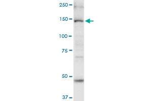 MYO6 monoclonal antibody (M02), clone 2E12.
