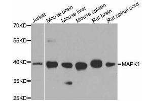 Western blot analysis of extracts of various cell lines, using MAPK1 antibody. (ERK2 anticorps  (AA 200-300))