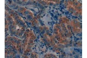 Figure. (MMP12 anticorps  (AA 290-469))