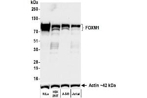 Western Blotting (WB) image for anti-Forkhead Box M1 (FOXM1) (AA 650-700) antibody (ABIN7795806)