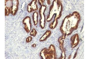 Image no. 1 for anti-Keratin 18 (KRT18) antibody (ABIN6179389) (Cytokeratin 18 anticorps)