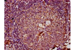 IHC image of ABIN7151049 diluted at 1:100 and staining in paraffin-embedded human tonsil tissue performed on a Leica BondTM system. (RNF160 anticorps  (AA 462-591))