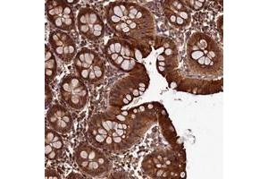 Immunohistochemical staining of human colon with LCMT2 polyclonal antibody  shows strong cytoplasmic positivity in glandular cells at 1:50-1:200 dilution.