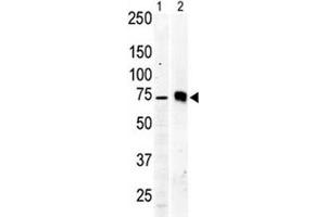 Western blot testing of PKC beta 2 antibody and Jurkat cell lysate (lane 1) and mouse brain tissue lysate (2). (PKC beta anticorps  (AA 642-673))
