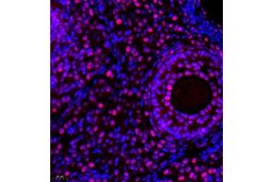 Immunofluorescence of paraffin embedded rat ovary using TFIIIC110 (ABIN7074038) at dilution of 1:650 (400x lens)