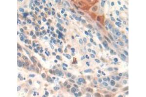 IHC-P analysis of Human Tissue, with DAB staining. (SPHK1 anticorps  (AA 148-398))