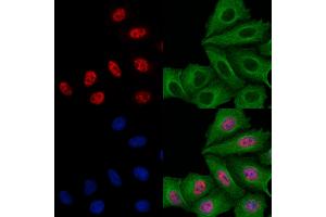 ABIN6258622 and ABIN6273497 staining Hela cells by IF/ICC. (SIVA1 anticorps  (Internal Region))