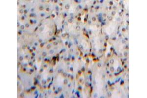 Used in DAB staining on fromalin fixed paraffin-embedded Kidney tissue (Dual Specificity Phosphatase 3 (DUSP3) (AA 2-185) anticorps)