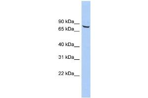 WB Suggested Anti-ACCN4 Antibody Titration: 0. (ACCN4 anticorps  (Middle Region))