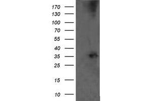 Western Blotting (WB) image for anti-T-cell surface glycoprotein CD1c (CD1C) antibody (ABIN2670667) (CD1c anticorps)