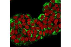 Immunofluorescence staining of paraformaldehyde-fixed MCF-7 cells with TFF1/pS2 Mouse Monoclonal Antibody (TFF1/2133) followed by goat anti-Mouse IgG-CF488 (Green).